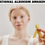 International Albinism Awareness Day