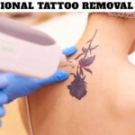National Tattoo Removal Day