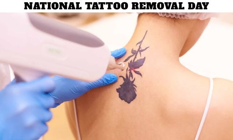 National Tattoo Removal Day